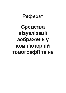 Реферат: Средства візуалізації зображень у комп'ютерній томографії та на цифрових рентгенографических системах